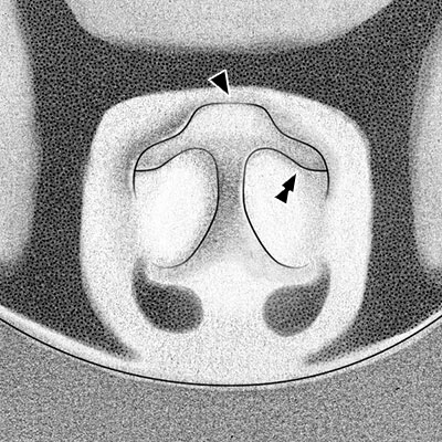 Datei:Pusillus Epigyne.jpg