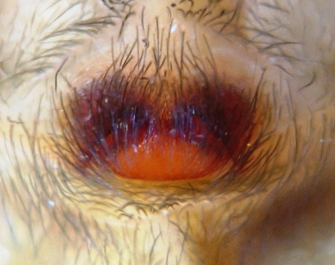 Datei:Amaurobius similis 033 E 3.jpg