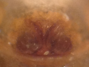 Datei:SilometopusCurtusEpigyneVentral.jpg