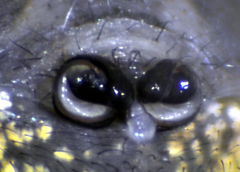 Datei:Gibbaranea gibbosa epigyne-800.jpg