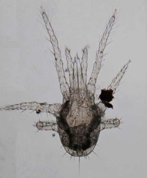Datei:Mesostigmata larva.jpg