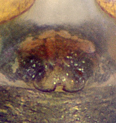 Datei:Gnathonarium detatum epigyne-12.06.10-482-4.jpg