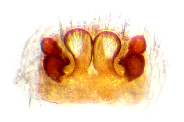 Datei:Pseudeuophrys obsoleta Vulva Schaefer.jpg