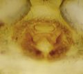 Epigyne