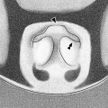 Pusillus Epigyne.jpg