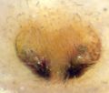 Epigyne