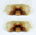Epigyne (oben) und Vulva (unten)
