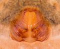 Epigyne