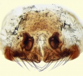 Epigyne