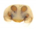 Vulva