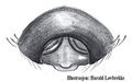 Epigyne