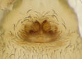 Epigyne