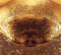Epigyne