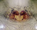 Epigyne