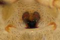 Epigyne