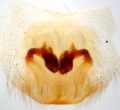 Vulva