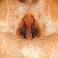 Epigyne
