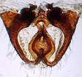 Vulva