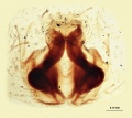 Vulva