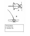 Trichobothrien