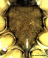 Sternum