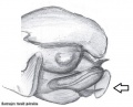 Pedipalpus (skizziert)