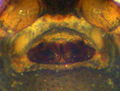 Epigyne