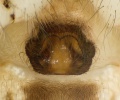Epigyne