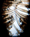 Chitinzapfen zwischen den Kopfkappen von Dicranolasma scabrum.