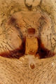 Epigyne