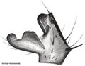 Tibialapophyse retrolateral