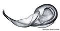 Embolus