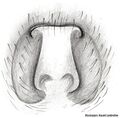 Epigyne