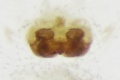 präparierte Epigyne