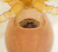 Epigyne