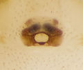 Epigyne