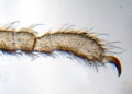 Ende eines Beines von Dicranolasma scabrum. Mikroskoppräparat.