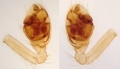 Pedipalpus