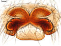 Epigyne (Mikroskoppräparat)