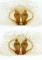 Epigyne (oben) und Vulva (unten)