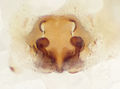Vulva