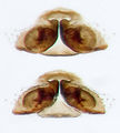 Epigyne (oben) und Vulva (unten)