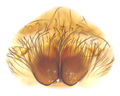 Epigyne