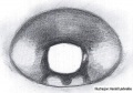 Epigyne