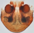 Epigyne