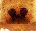 Epigyne