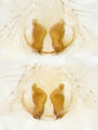 Epigyne (oben) und Vulva (unten)