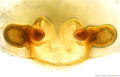 Vulva