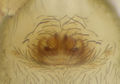 Epigyne