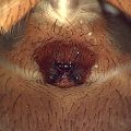 Epigyne